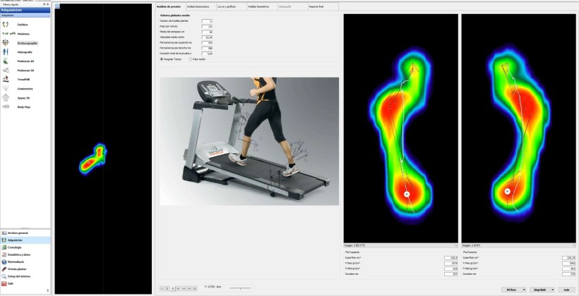 Estudio Biomecánico en Carrera