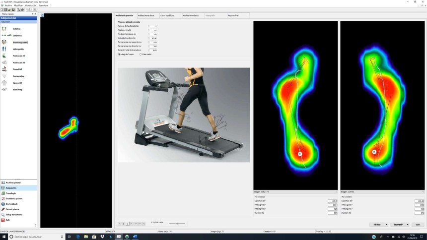 Estudio Biomecánico en Carrera