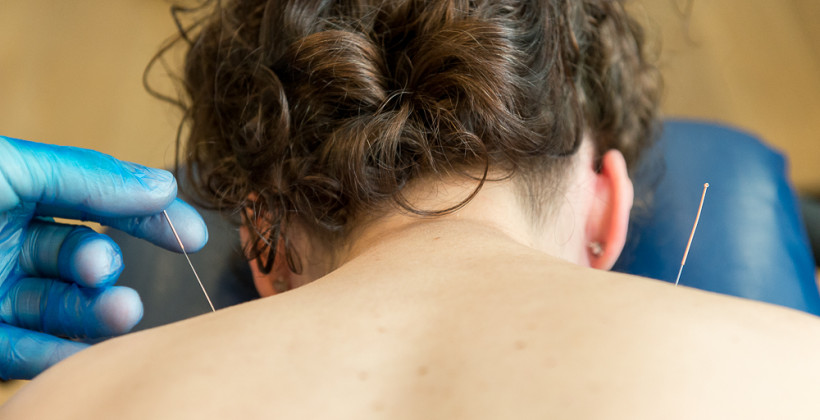 Fisioterapia Invasiva